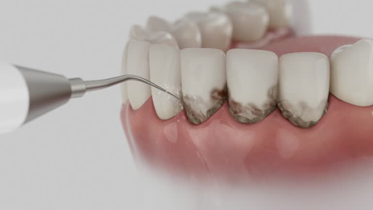 Reliable Dental Implants contractor in Riverview, SC by Smile Center Dentistry